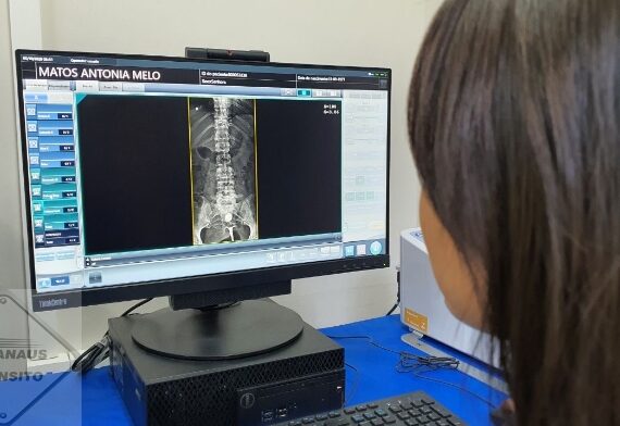 Foto: Rodrigo Santos- SES/AM